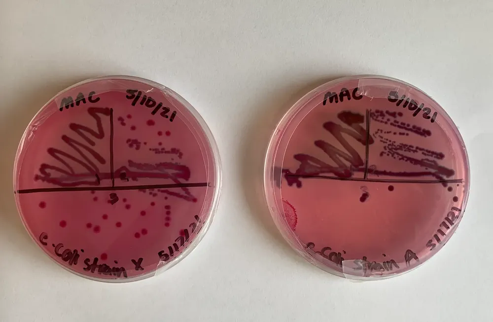 Two petri dishes of cultured bacteria